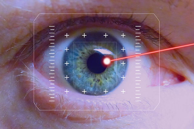 LASIK eye example